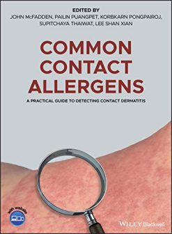 Common Contact Allergens: A Practical Guide to Detecting Contact Dermatitis (Original PDF from Publisher)