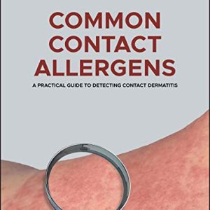 Common Contact Allergens: A Practical Guide to Detecting Contact Dermatitis (Original PDF from Publisher)