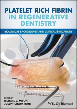 Platelet Rich Fibrin in Regenerative Dentistry: Biological Background and Clinical Indications (PDF)