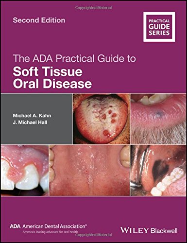 The ADA Practical Guide to Soft Tissue Oral Disease (Original PDF from Publisher)