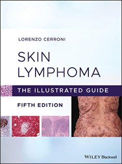 Skin Lymphoma: The Illustrated Guide, 5th Edition (Original PDF from Publisher)