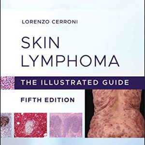 Skin Lymphoma: The Illustrated Guide, 5th Edition (Original PDF from Publisher)