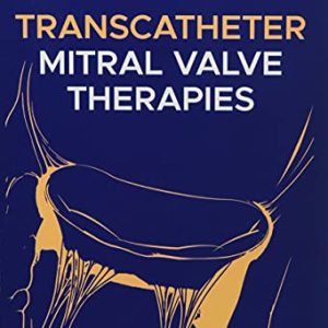 Transcatheter Mitral Valve Therapies (Original PDF from Publisher)