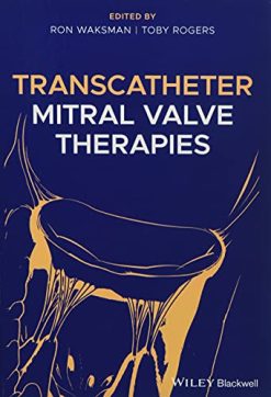 Transcatheter Mitral Valve Therapies (EPUB)