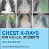 Chest X-Rays for Medical Students: CXRs Made Easy, 2nd Edition (Original PDF from Publisher)