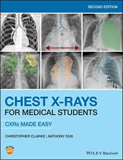 Chest X-Rays for Medical Students: CXRs Made Easy, 2nd Edition (Original PDF from Publisher)