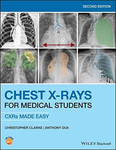 Chest X-Rays for Medical Students: CXRs Made Easy, 2nd Edition (Original PDF from Publisher)