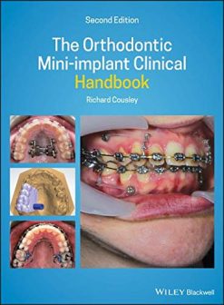 The Orthodontic Mini-implant Clinical Handbook, 2nd Edition