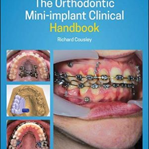 The Orthodontic Mini-implant Clinical Handbook, 2nd Edition