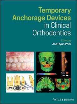 Temporary Anchorage Devices in Clinical Orthodontics  (Original PDF from Publisher)