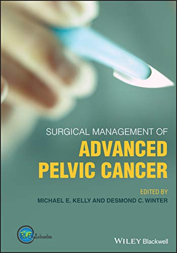 Surgical Management of Advanced Pelvic Cancer (Original PDF from Publisher)