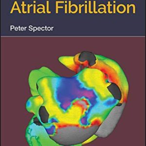 Understanding Atrial Fibrillation (Original PDF from Publisher)