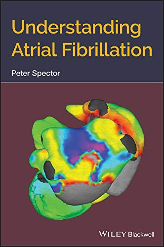 Understanding Atrial Fibrillation (Original PDF from Publisher)