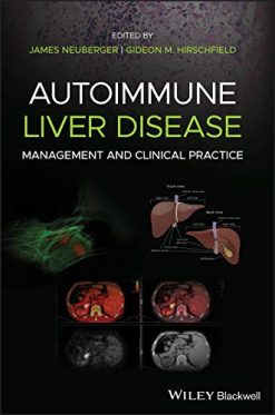 Autoimmune Liver Disease: Management and Clinical Practice