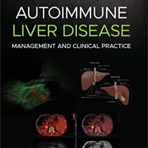 Autoimmune Liver Disease: Management and Clinical Practice