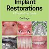 Implant Restorations: A Step-by-Step Guide, 4th Edition
