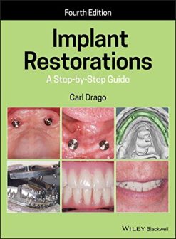 Implant Restorations: A Step-by-Step Guide, 4th Edition