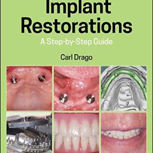 Implant Restorations: A Step-by-Step Guide, 4th Edition