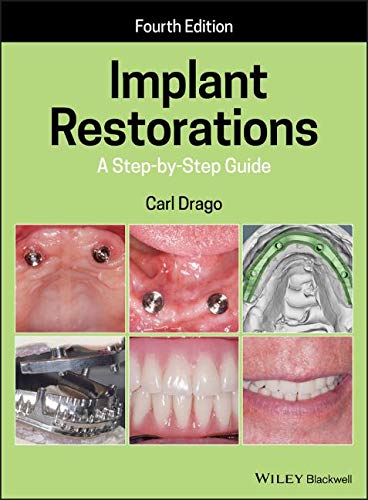 Implant Restorations: A Step-by-Step Guide, 4th Edition