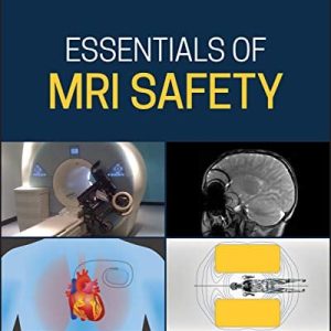Essentials of MRI Safety (Original PDF from Publisher)