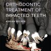 Orthodontic Treatment of Impacted Teeth, 4th Edition (EPUB)