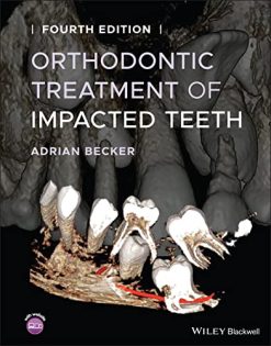 Orthodontic Treatment of Impacted Teeth, 4th Edition (EPUB)