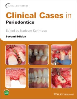 Clinical Cases in Periodontics, 2nd Edition (EPUB)