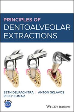 Principles of Dentoalveolar Extractions (Original PDF from Publisher)