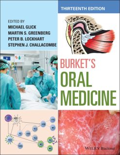 Burket’s Oral Medicine, 13th Edition (EPUB)