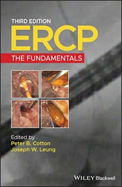 ERCP: The Fundamentals, 3rd Edition (EPUB)
