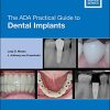 The ADA Practical Guide to Dental Implants (Original PDF from Publisher)