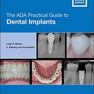 The ADA Practical Guide to Dental Implants (Original PDF from Publisher)