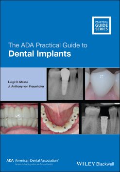 The ADA Practical Guide to Dental Implants (EPUB)