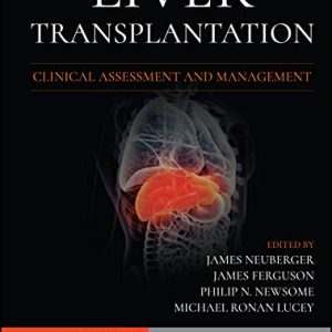 Liver Transplantation: Clinical Assessment and Management, 2nd Edition (Original PDF from Publisher)