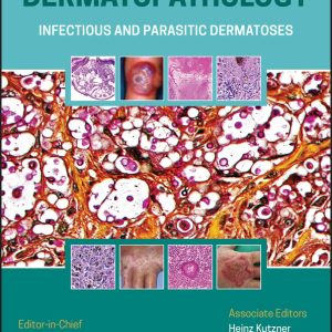 Atlas of Clinical Dermatopathology: Infectious and Parasitic Dermatoses (EPUB)
