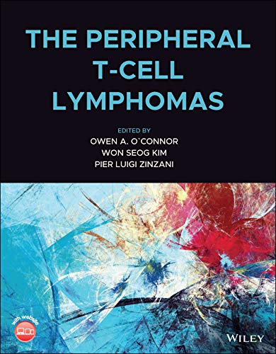 The Peripheral T-Cell Lymphomas (Original PDF from Publisher)