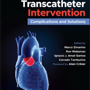 Aortic Valve Transcatheter Intervention: Complications and Solutions (EPUB)