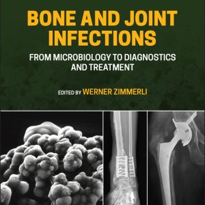 Bone and Joint Infections: From Microbiology to Diagnostics and Treatment, 2nd Edition (EPUB)