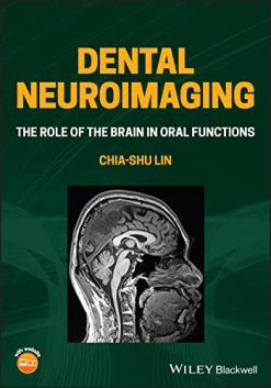 Dental Neuroimaging: The Role of the Brain in Oral Functions (Original PDF from Publisher)