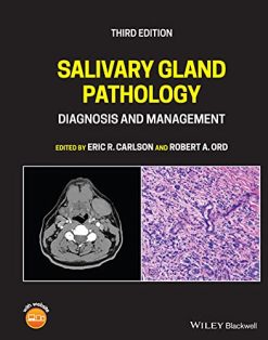 Salivary Gland Pathology: Diagnosis and Management, 3rd Edition (Original PDF from Publisher)