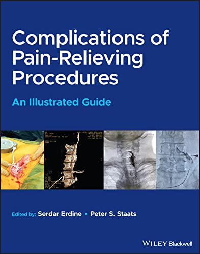 Complications of Pain-Relieving Procedures: An Illustrated Guide (EPUB)