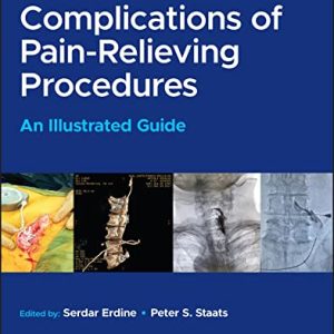 Complications of Pain-Relieving Procedures: An Illustrated Guide (Original PDF from Publisher)