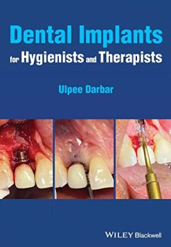 Dental Implants for Hygienists and Therapists (Original PDF from Publisher)