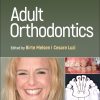 Adult Orthodontics, 2nd Edition (EPUB)