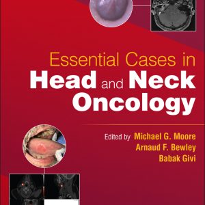 Essential Cases in Head and Neck Oncology (EPUB)