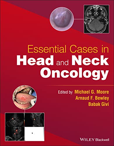 Essential Cases in Head and Neck Oncology (Original PDF from Publisher)