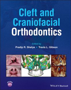 Cleft and Craniofacial Orthodontics (Original PDF from Publisher)