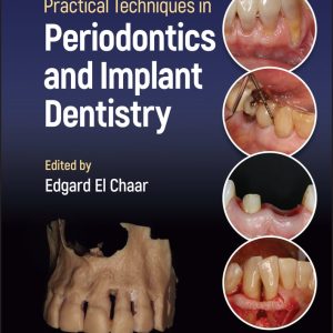 Practical Techniques in Periodontics and Implant Dentistry (EPUB)