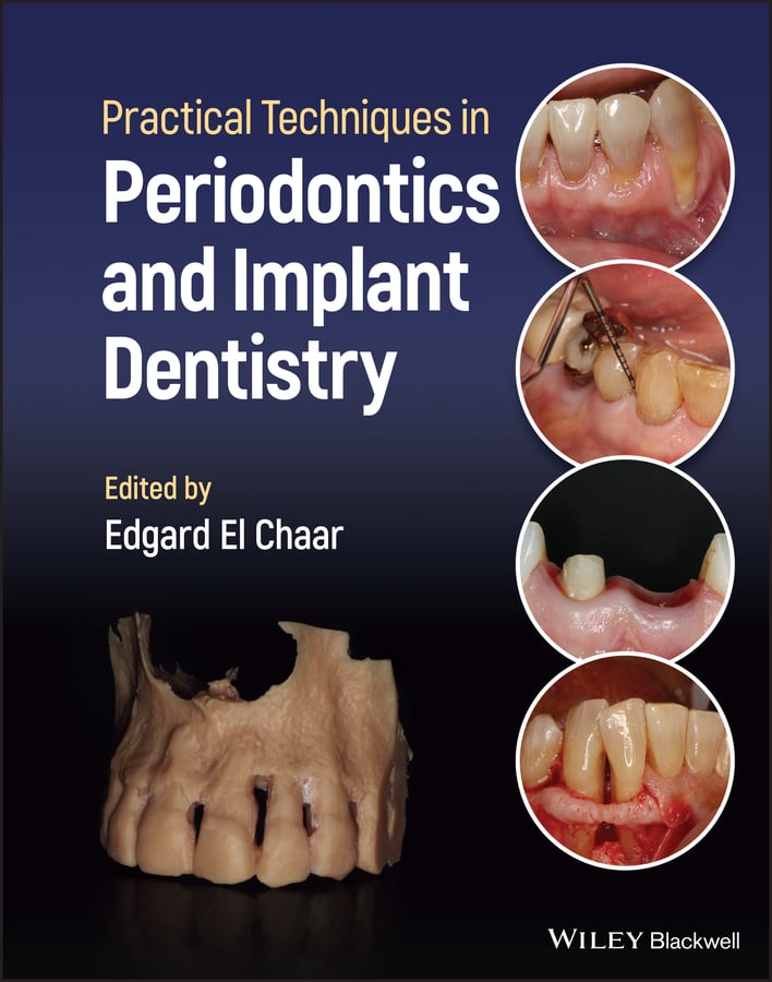 Practical Techniques in Periodontics and Implant Dentistry (EPUB)
