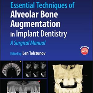 Essential Techniques of Alveolar Bone Augmentation in Implant Dentistry: A Surgical Manual, 2nd Edition (Original PDF from Publisher)